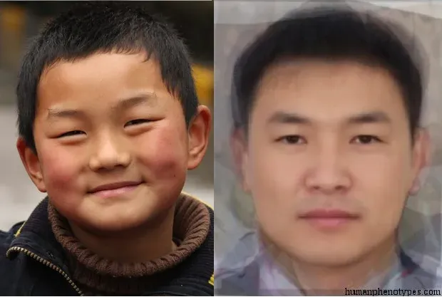 Mongol child and Gobid phenotype